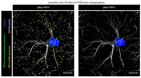 ofgfap|Glial Fibrillary Acidic Protein